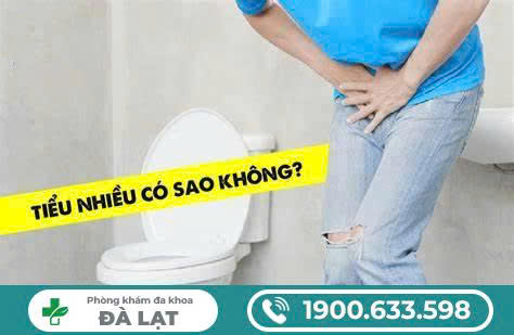 Hình ảnh minh họa